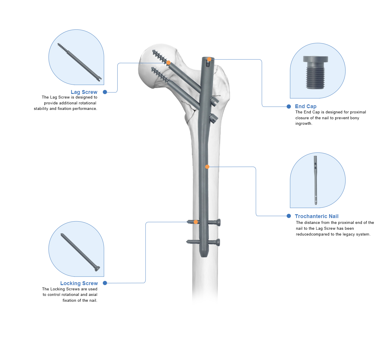 Gamma Intramedullary Nail Box