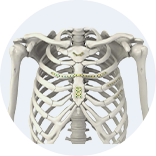 Expert Femoral Intramedullary Nail