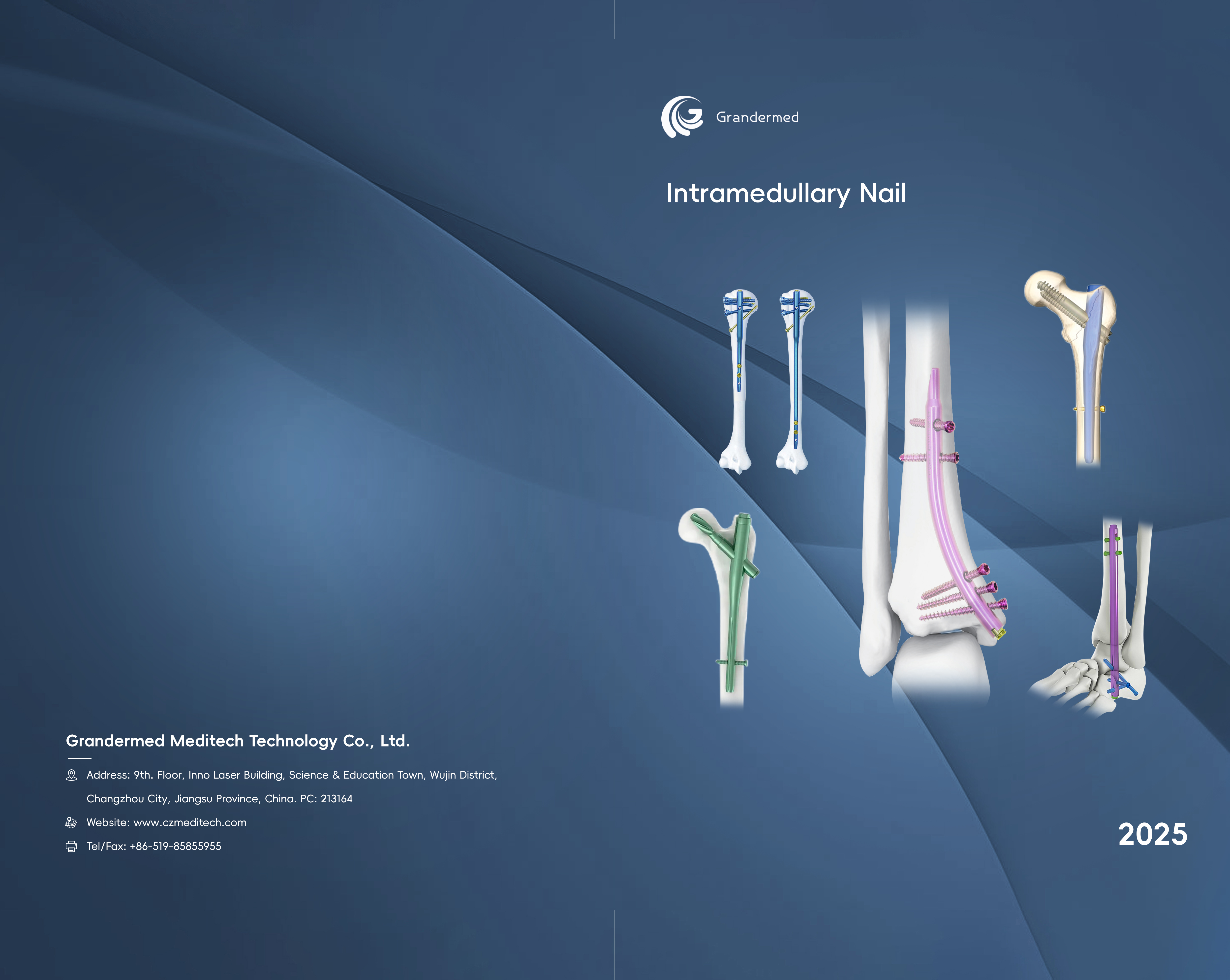 <a href="//rirorwxhnppilm5m.ldycdn.com/%E5%AD%90%E6%AF%8D%E9%AB%93%E5%86%85%E9%92%89%E5%9B%BE%E5%86%8C-aidllBpiKmolmSRilnnlirkkq.pdf"><strong>Downlaod</strong></a>