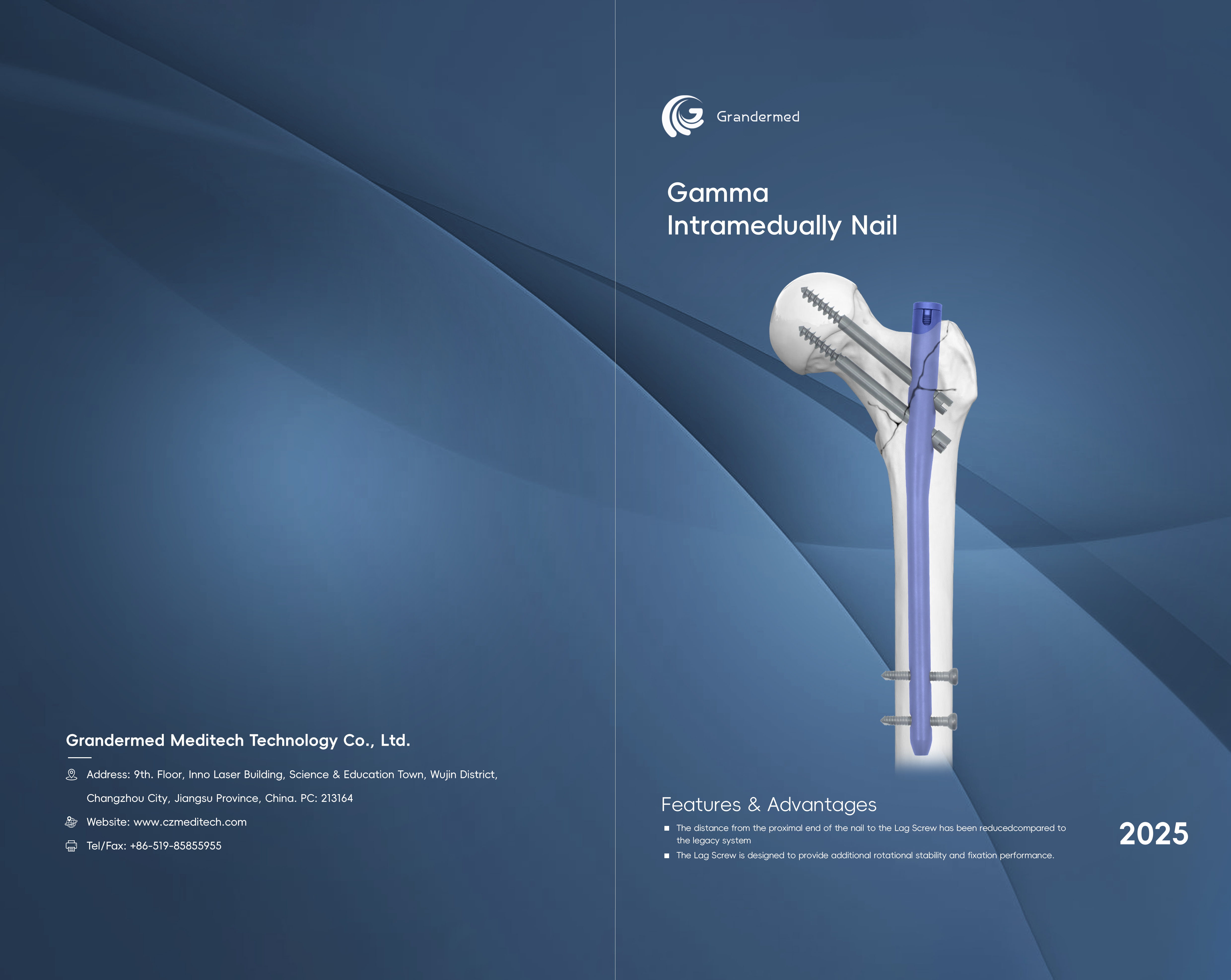 <a href="//rirorwxhnppilm5m.ldycdn.com/%E5%AD%90%E6%AF%8D%E9%AB%93%E5%86%85%E9%92%89%E5%9B%BE%E5%86%8C-aidllBpiKmolmSRilnnlirkkq.pdf"><strong>Downlaod</strong></a>