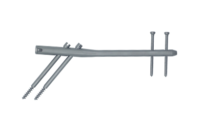 Gamma Intramedullary Nail