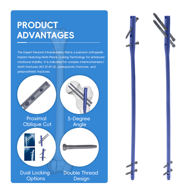 Expert Femoral Intramedullary Nail