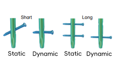 PFNA Intramedullary Nail Box
