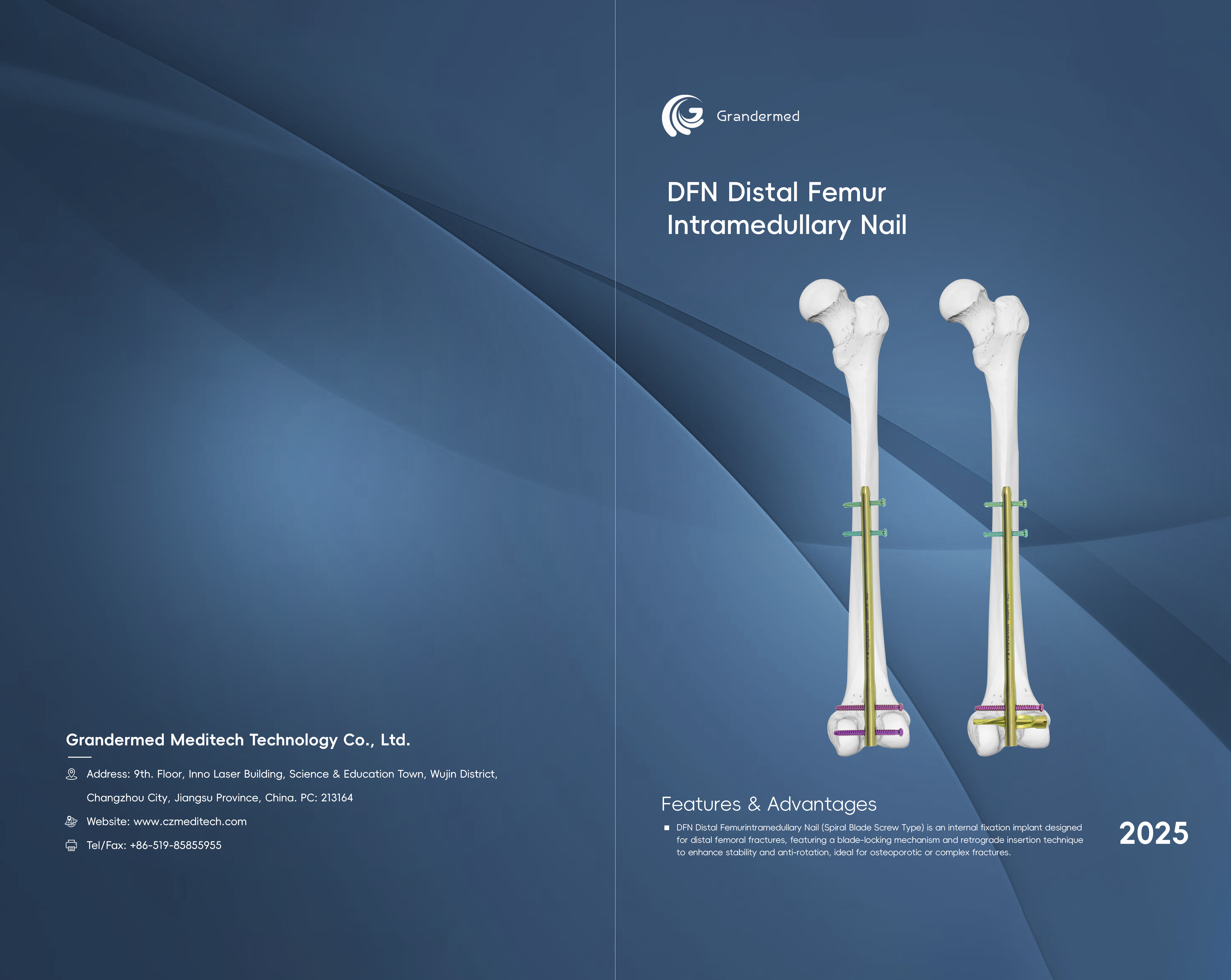 <a href="//jkrorwxhnppilm5m.ldycdn.com/%E5%AD%90%E6%AF%8D%E9%AB%93%E5%86%85%E9%92%89%E5%9B%BE%E5%86%8C-aidllBpiKmolmSRilnnlirkkq.pdf"><strong>Downlaod</strong></a>