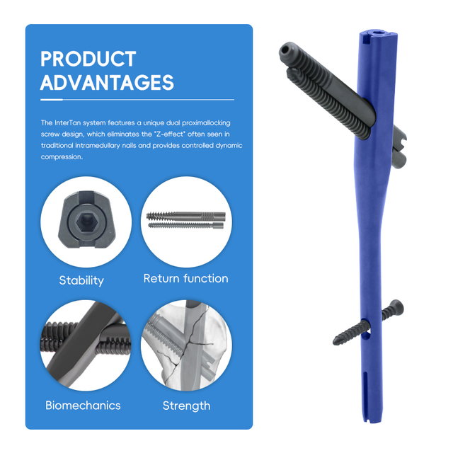 Intertan Intramedullary Nail