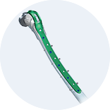 Expert Femoral Intramedullary Nail