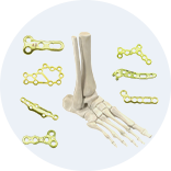 Expert Femoral Intramedullary Nail