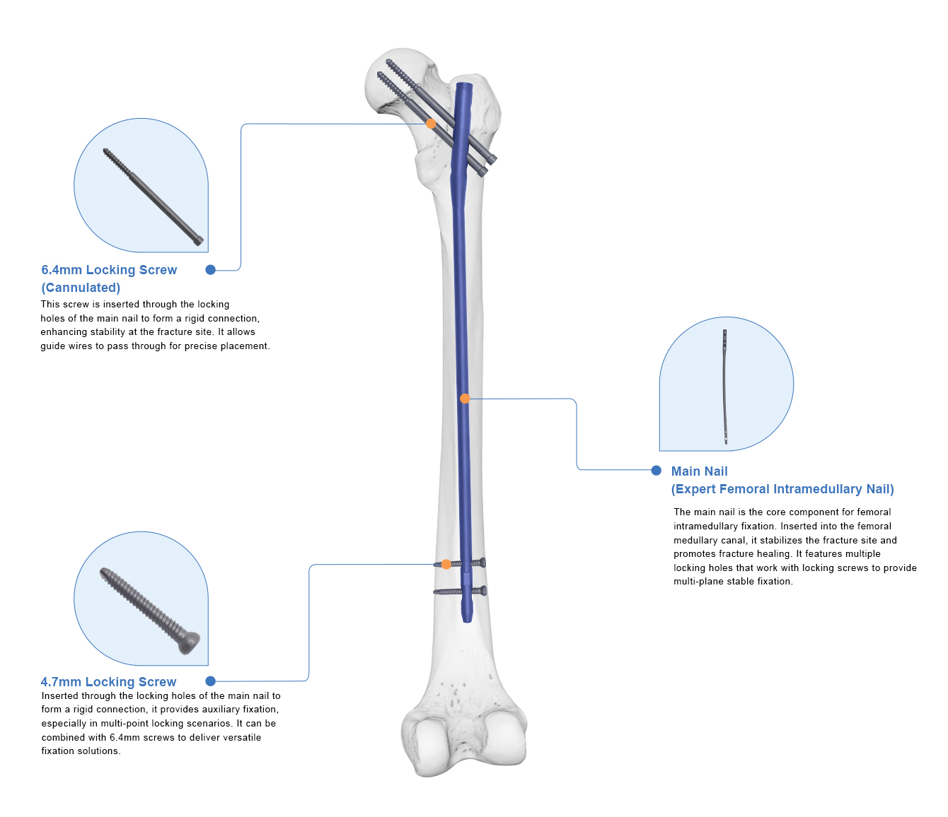 Expert Femoral Intramedullary Nail Box