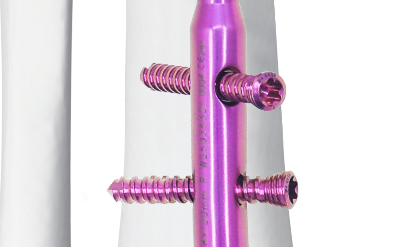 Distal Tibial Intramedullary Nail (DTN)