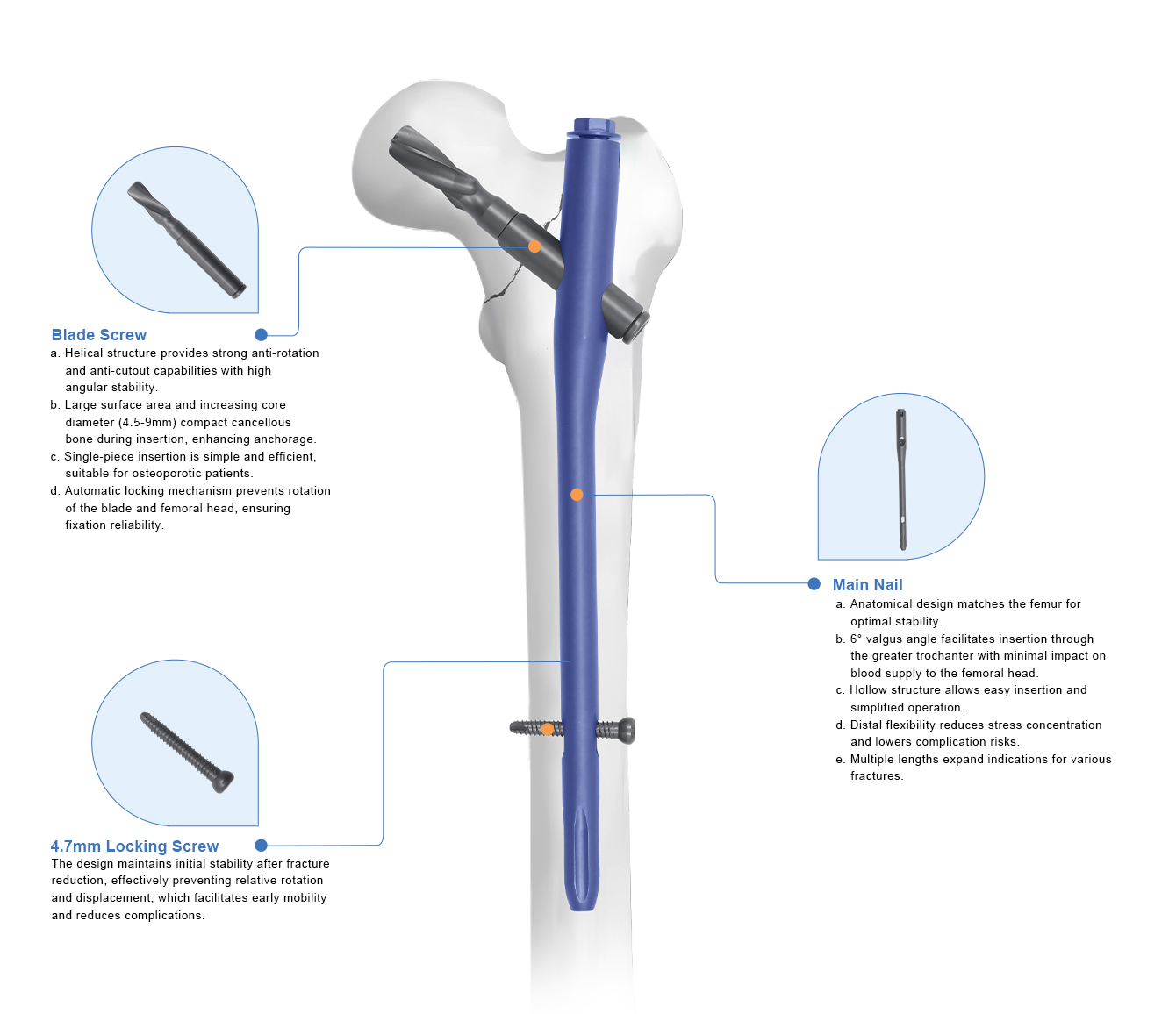 PFNA Intramedullary Nail Box