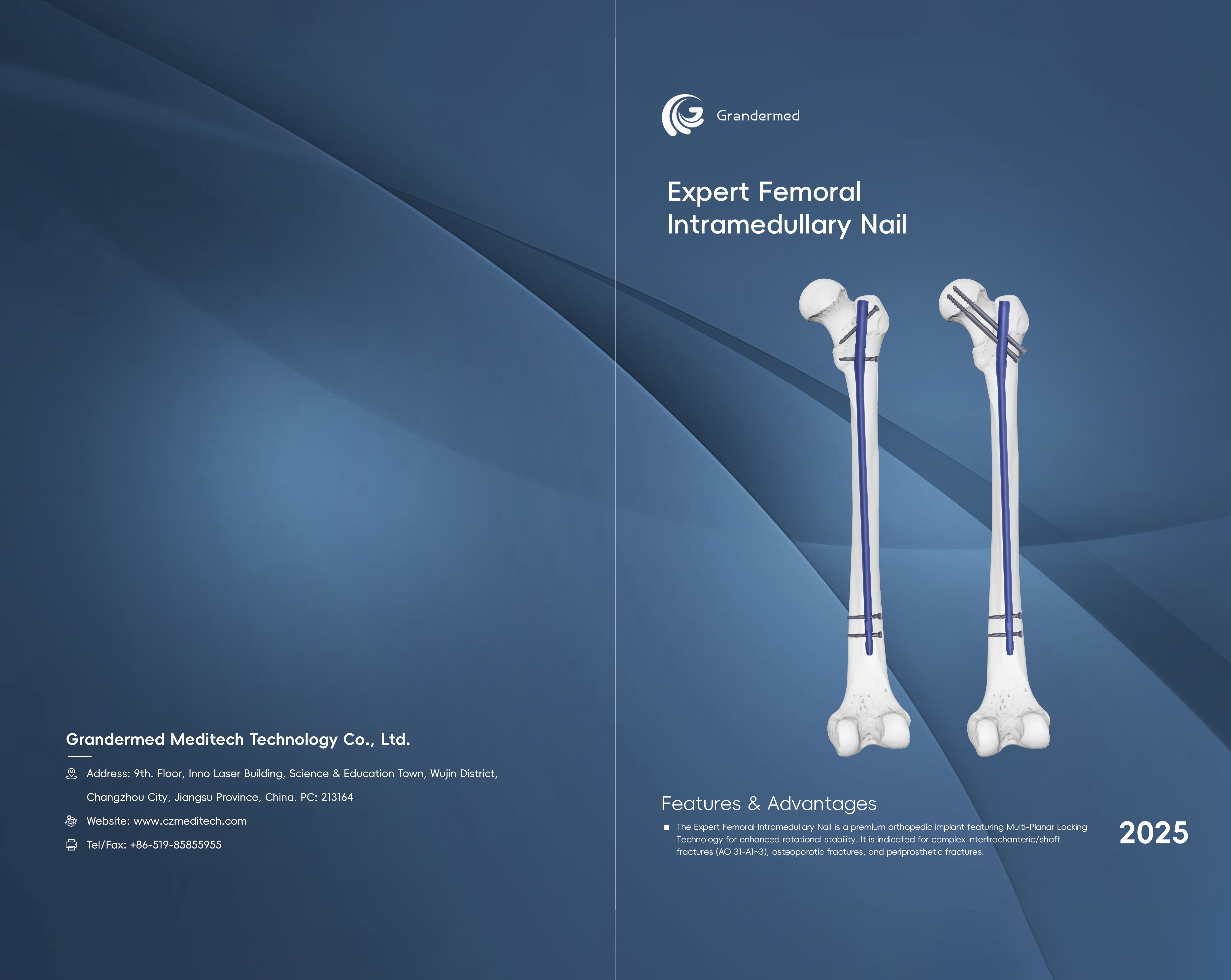 <a href="//jkrorwxhnppilm5m.ldycdn.com/%E5%AD%90%E6%AF%8D%E9%AB%93%E5%86%85%E9%92%89%E5%9B%BE%E5%86%8C-aidllBpiKmolmSRilnnlirkkq.pdf"><strong>Downlaod</strong></a>