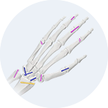 Expert Femoral Intramedullary Nail